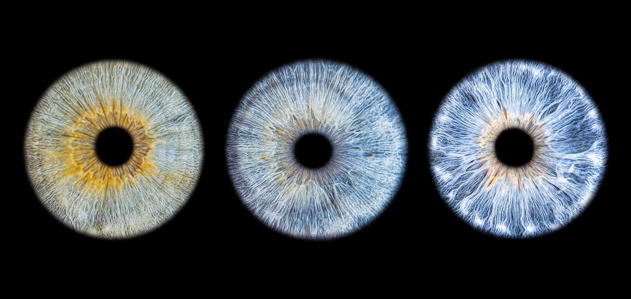 iris yeux photo photographe alsace lorraine studio oeil tableau humain animal animaux chat cheval nac chien saverne strasbourg nancy metz paris