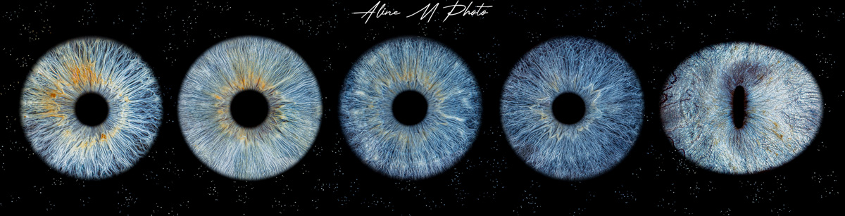 photo yeux rétine iris alsace saverne strasbourg france marmoutier